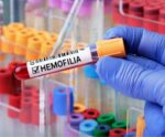 Dia Nacional da Pessoa com Hemofilia: conheça sobre essa doença rara