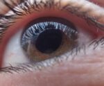 Glaucoma: milhões de brasileiros vivem sem diagnóstico