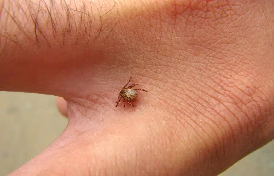 Febre maculosa