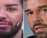 Homem faz mais de 30 cirurgias plásticas para se parecer com Ricky Martin
