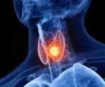 ANS inclui tratamento de câncer de tireoide na cobertura obrigatória