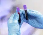 Projeto quer tornar diagnóstico de infarto mais rápido no ES