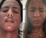 Mulher de Frank Aguiar detalha internação na UTI por doença rara