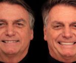 Bolsonaro diz que ‘não pagou nada’ por harmonização dentária