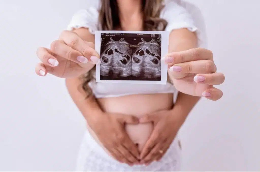 sêxtuplos capixabas