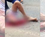Motociclista fica gravemente ferido após acidente em Jerônimo Monteiro