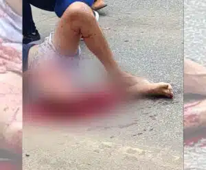 Motociclista fica gravemente ferido após acidente em Jerônimo Monteiro
