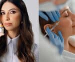 Botox: tudo que você precisa saber sobre este procedimento de beleza
