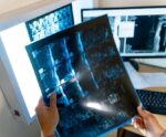 Radiologia musculoesquelética: o que você precisa saber