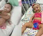 Ajude a Emilly! Familiares pedem doação para tratamento em Cachoeiro