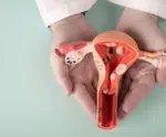 Endometriose gera câncer? Entenda a relação entre as condições