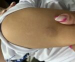 Criança mordida por cuidadora em escola de Cachoeiro será indenizada
