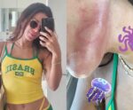 Anitta diz ter sido ‘eletrocutada’ por água-viva, perde unha e vai parar no hospital