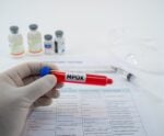 Com 48 casos confirmados no ES, mpox pode causar danos graves à visão