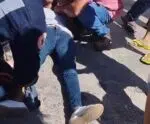 Jovem de 17 anos é atropelada por motocicleta em Atílio Vivacqua
