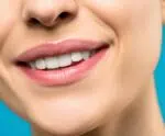 É seguro tentar clarear os dentes em casa ?