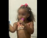 Menina de 3 anos cai em creche e sofre traumatismo craniano