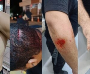 Seguranças são atacados com facão durante carnaval em Mimoso do Sul
