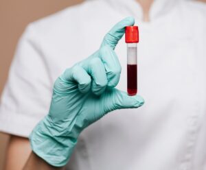 Alunos refazem exames após erro com agulha em escola do ES A foto mostra um exame de sangue