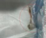 VÍDEO | Rato morto é encontrado dentro de fralda de bebê Rato na Fralda