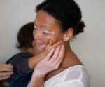 A foto mostra mãe com vitiligo