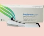 Implanon e DIU no SUS: entenda esses contraceptivos