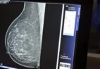 Mamografia indolor é possível graças ao avanço da tecnologia – leia