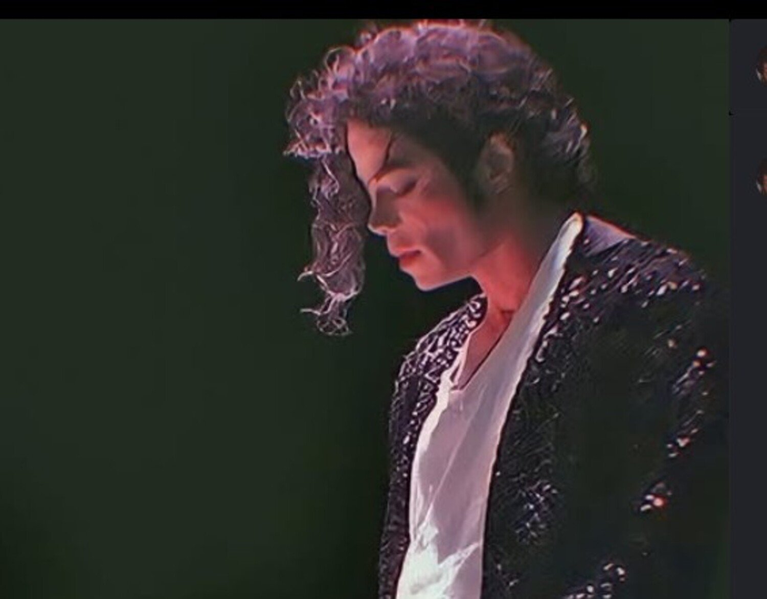 A foto mostra Michael Jackson vítima de vitiligo
