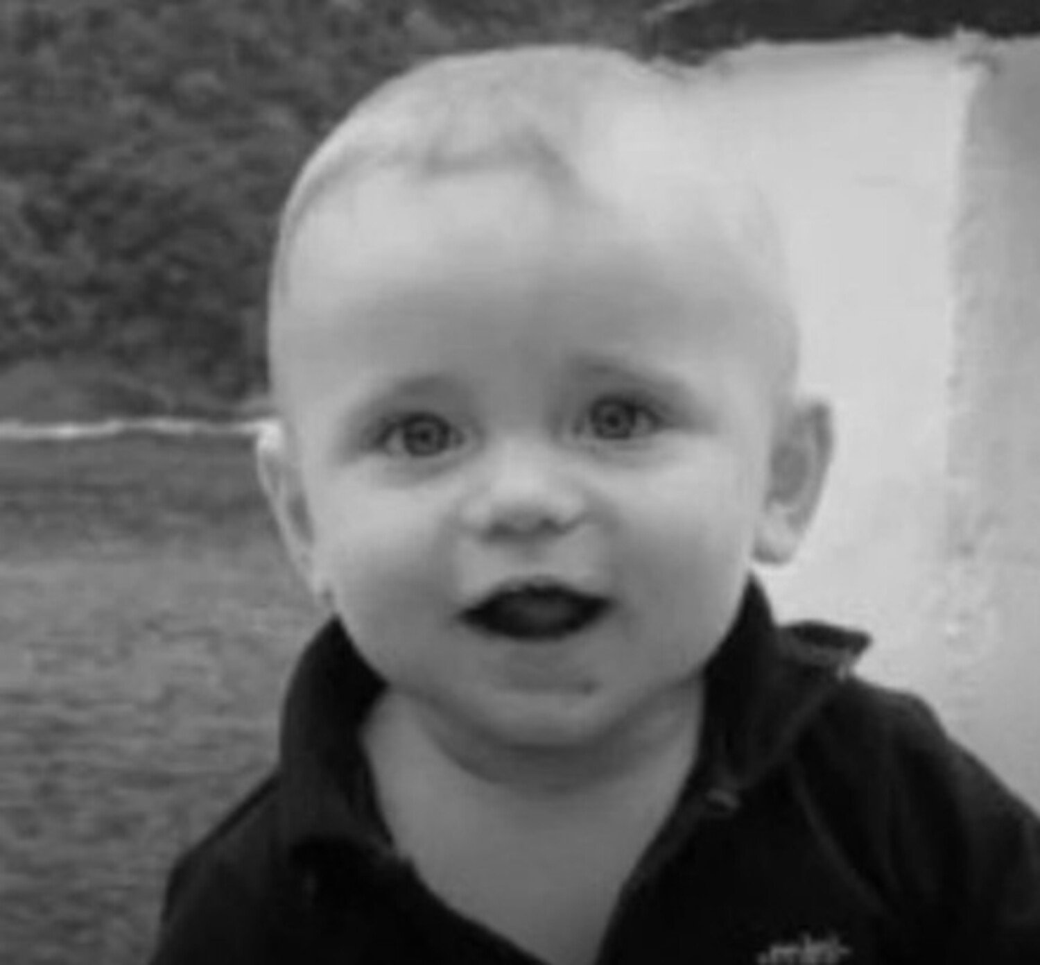 A foto mostra bebê vítima de meningite