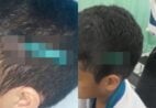 Cenas fortes: estudante finca lápis na cabeça de colega durante briga em escola