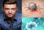 Doença de Lyme – saiba o que afeta Justin Timberlake