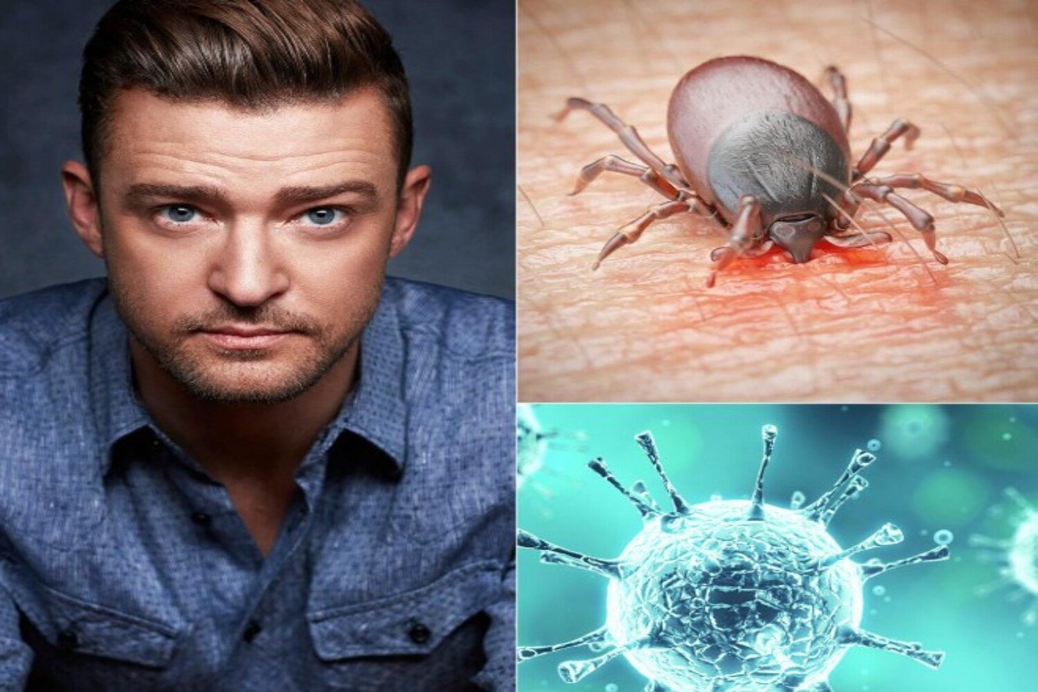 A foto mostra Justin Timberlake, cantor vítima de doença de Lyme.