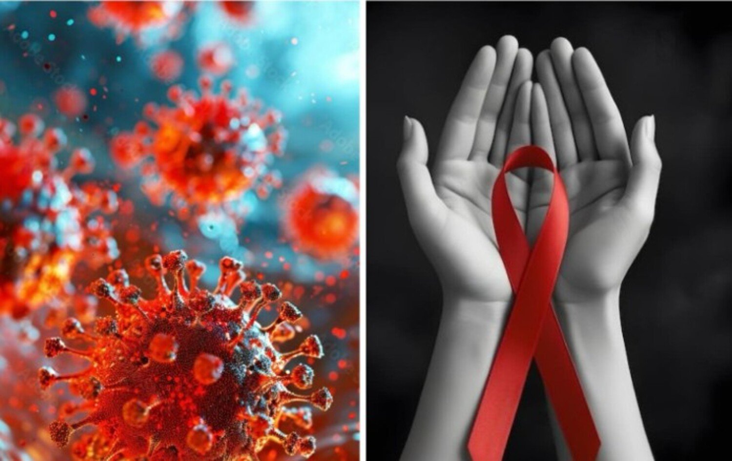 A foto alude à Aids/HIV