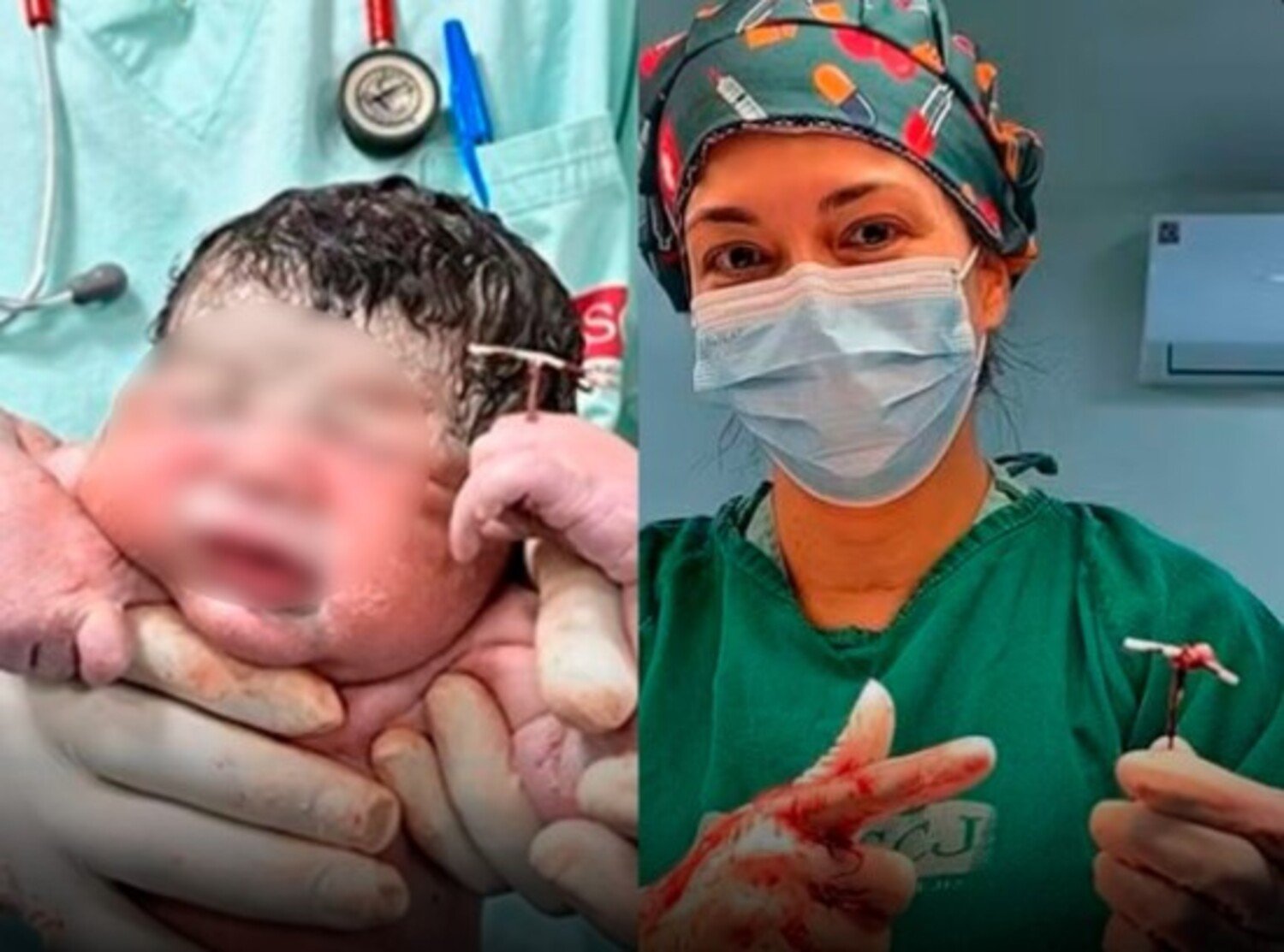A foto mostra bebê que nasceu segurando DIU - contraceptivo