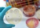 Alerta: resistência antimicrobiana já é tratada como pandemia global