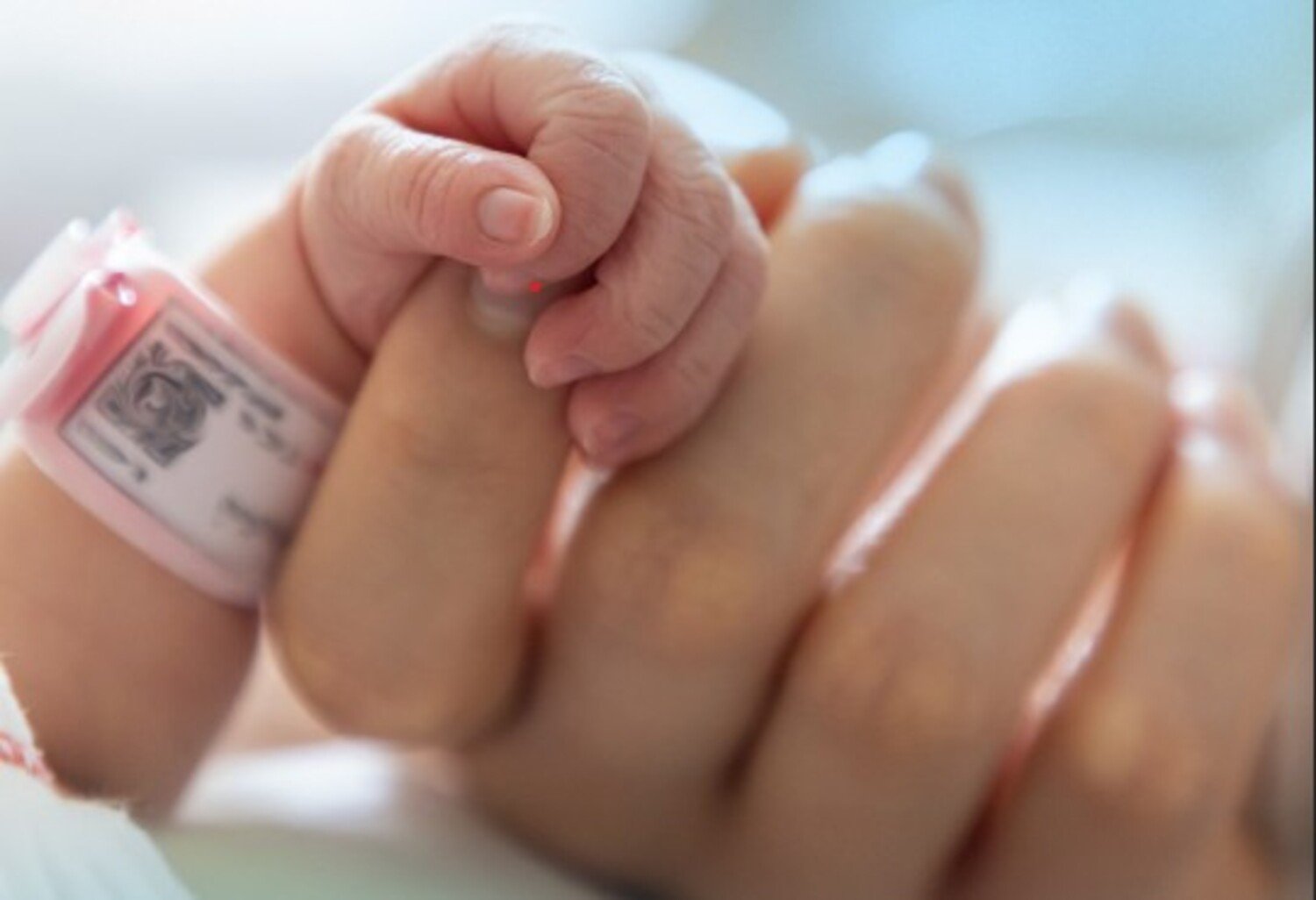 A foto mostra bebê prematura