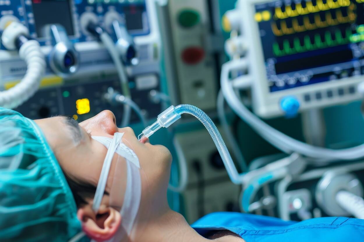 - a foto mostra pessoa intubada