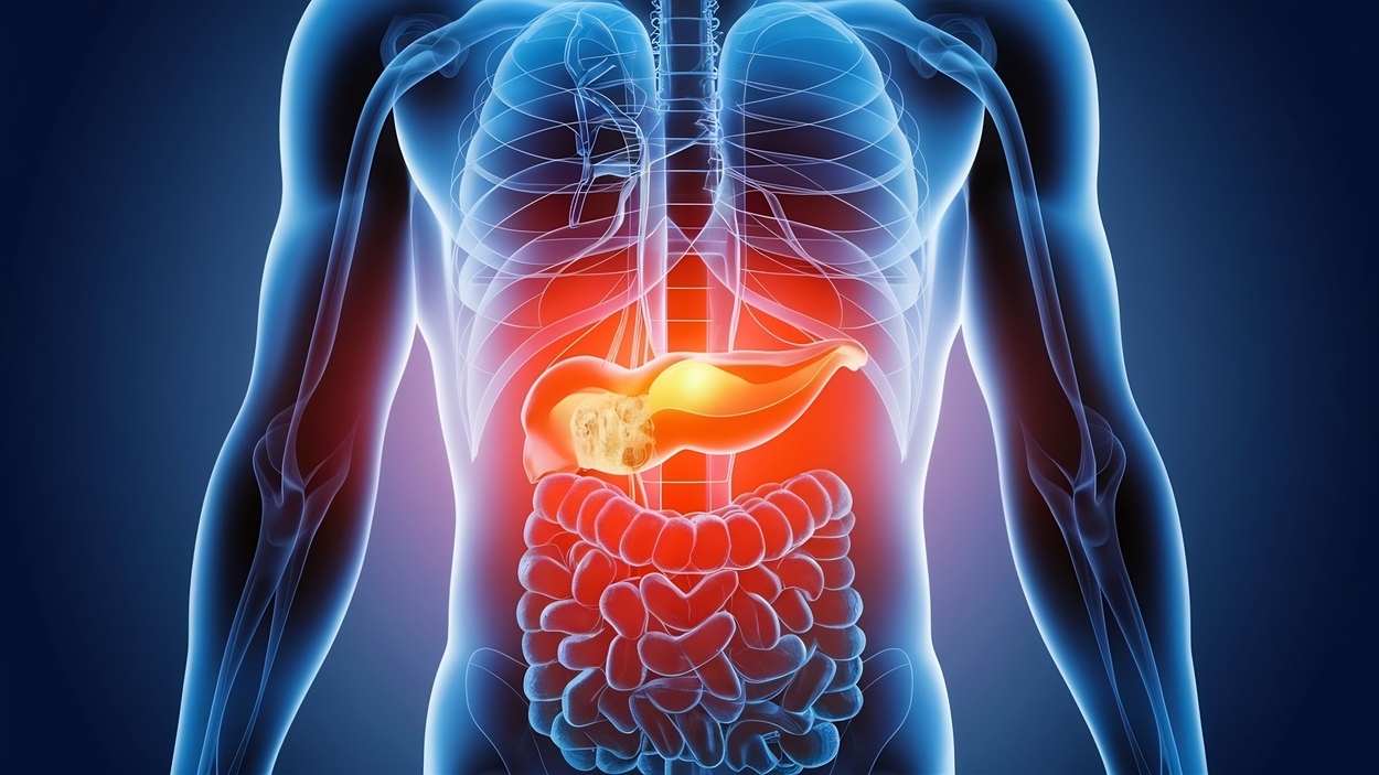 A foto laude à pancreatite