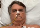 Pneumonia após broncoaspiração: entenda caso Bolsonaro