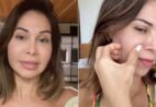 Maíra Cardi revela descoberta de uso de preenchedor permanente e detalha cirurgia