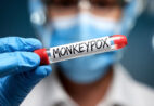 Você pode pegar mpox sem sair de casa; entenda