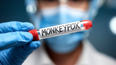 Você pode pegar mpox sem sair de casa; entenda