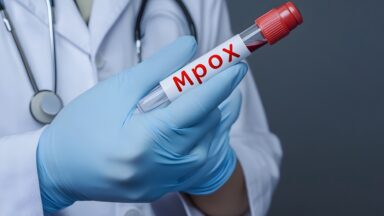 Cachoeiro confirma Mpox e liga sinal vermelho