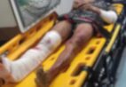 Polícia prende três após agressão brutal contra mulher em Cachoeiro