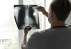 Dr. Leandro Baptista alerta: cuidados com hábitos que prejudicam a saúde pulmonar