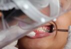 Julho Neon reforça a importância da saúde bucal e da prevenção ao câncer de boca