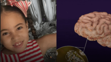 Ameba comedora de cérebros: não é filme B, é real. Veja sintomas e prevenção