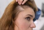 Cabelo demora a crescer? Veja o que ajuda de verdade