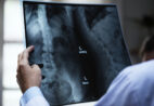 Exames de imagem crescem e desafiam serviços de radiologia