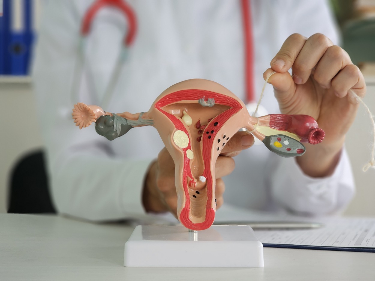 A foto mostra médica com aparelho reprodutor feminino